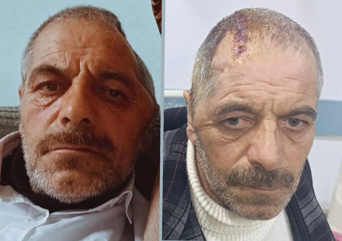 Mezarı kazılan hasta, Ağrı’da ilk kez yapılan ameliyatla hayata tutundu